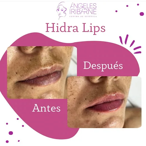 Ángeles Iribarne Málaga